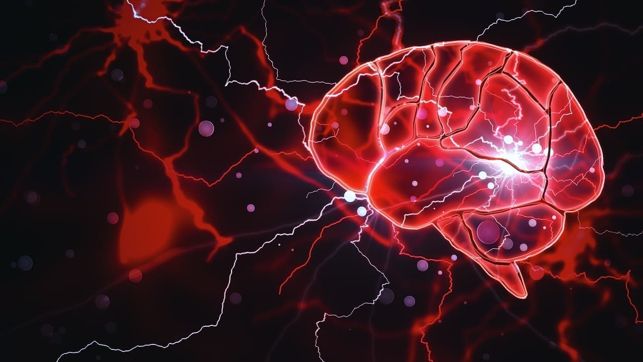 What Is a Brain Infarct? Causes, Types, and Key Definitions Explained