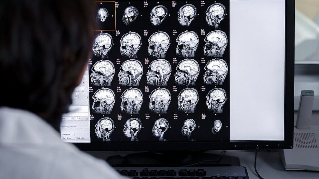 brain lesions symptoms