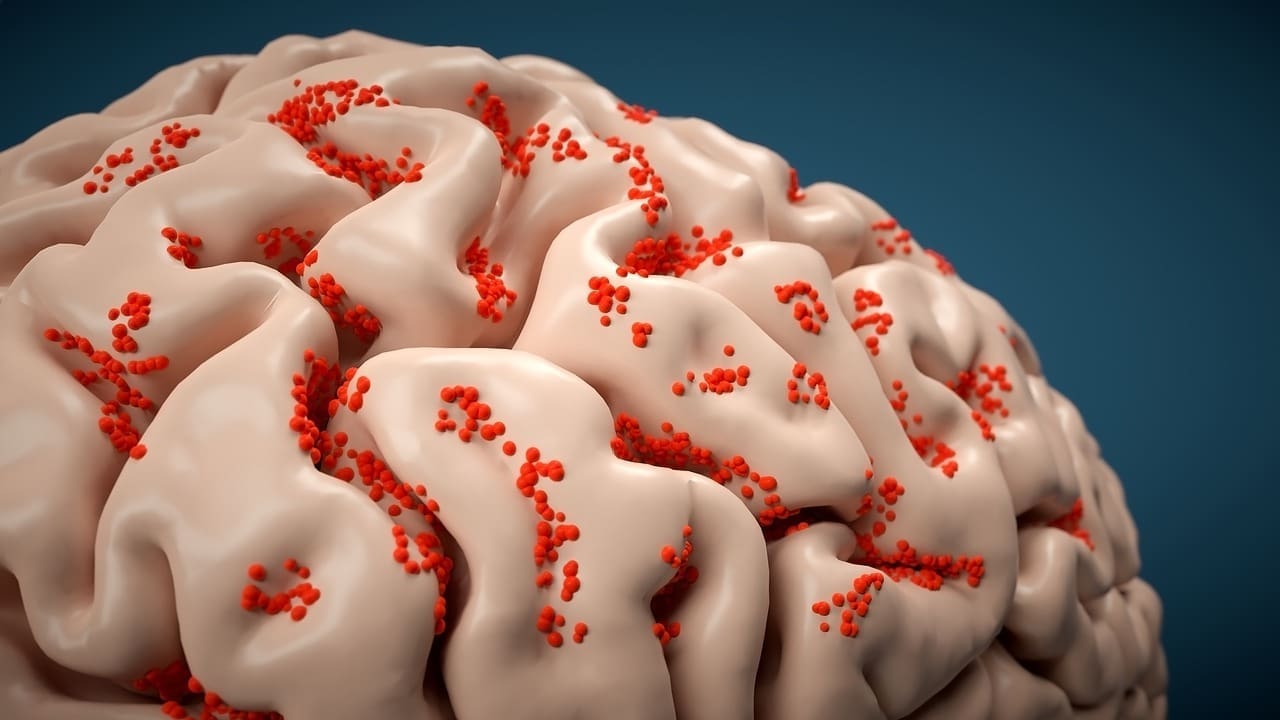 Brain Shunt Procedure: 7 Key Facts About Shunt Surgery and Lifelong Care