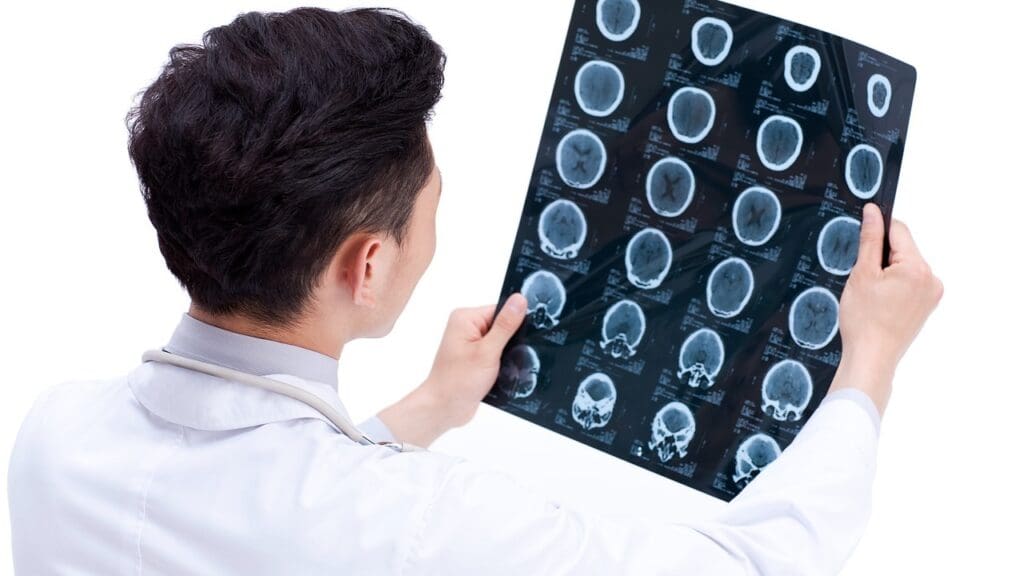 brain surgery recovery factors brain surgery recovery factors