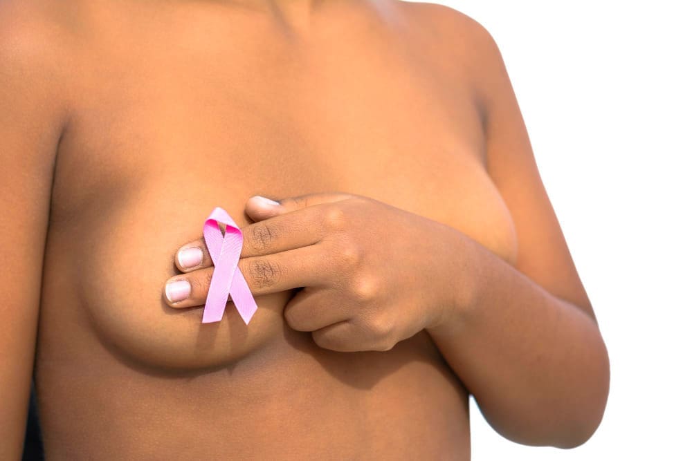 10 Natural Remedies for Breast Cancer: Evidence-Based Options You Can Explore