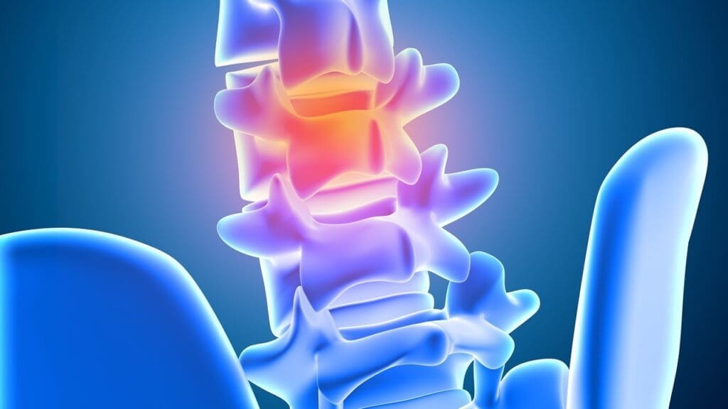 bulging disc sciatic nerve bulging disc sciatic nerve