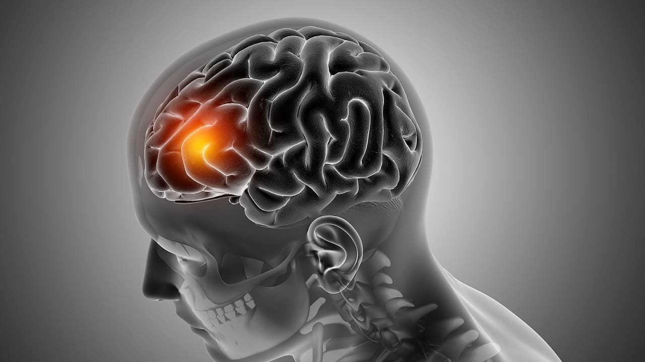 Brain Cancer Survival Rates: 9 Key Facts to Know