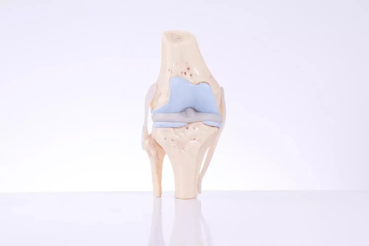 Cemented Knee Replacement: 7 Key Facts About Materials, Longevity, and Recovery