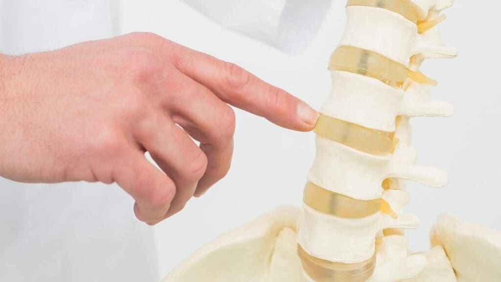 central disk protrusion central disk protrusion