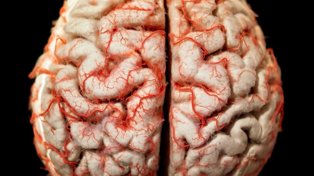 Cerebral Cysts: 9 Key Symptoms, Risks, and MRI Findings to Know