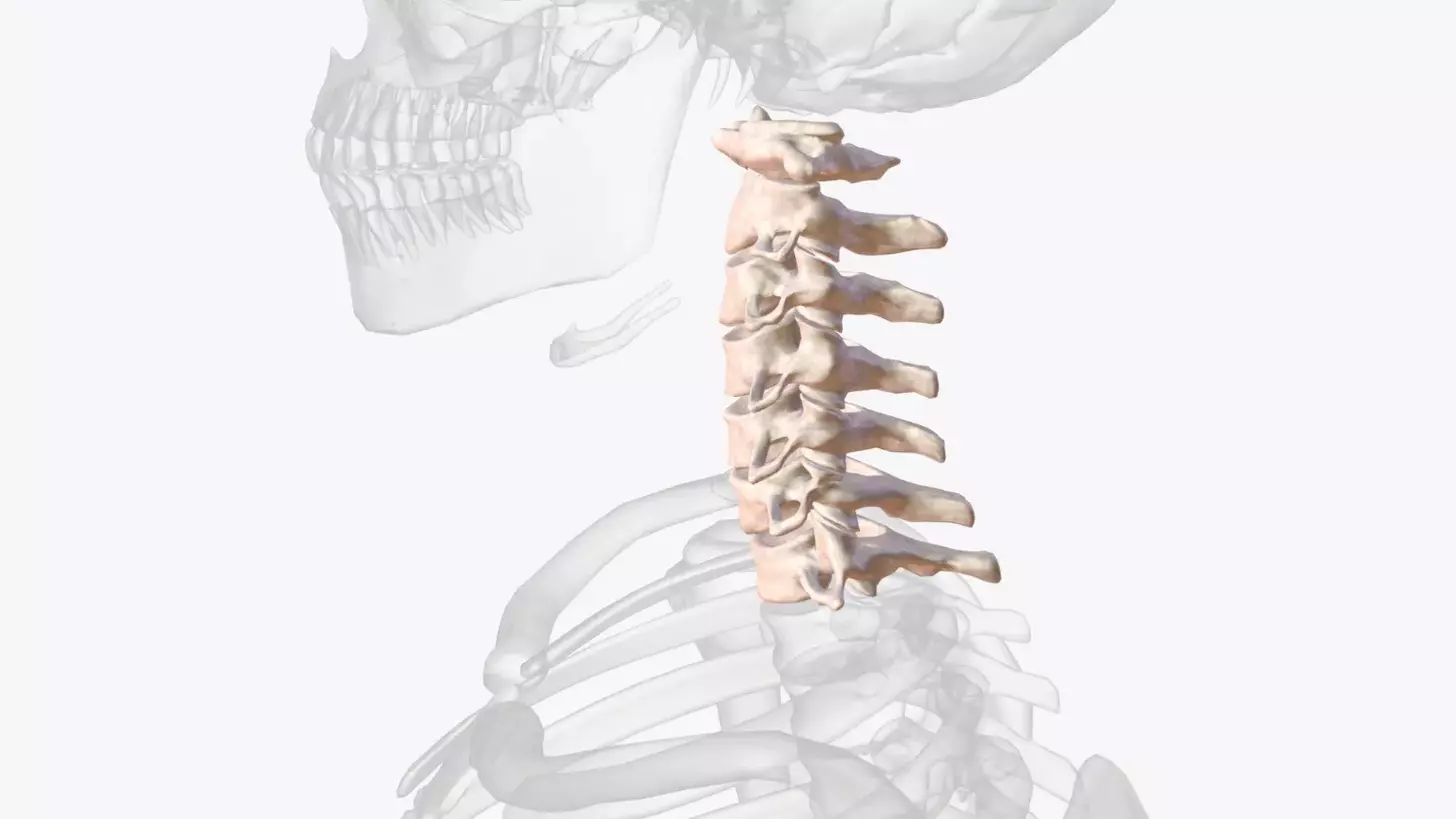 Cervical Spine Fusion: 7 Key Facts for a Successful Surgery and Recovery