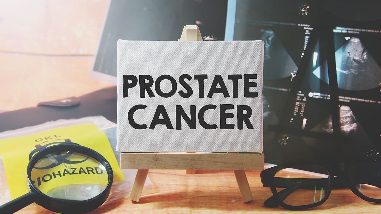 Chemotherapy for Prostate Cancer: 7 Essential Facts About Treatment, Drugs, and Side Effects