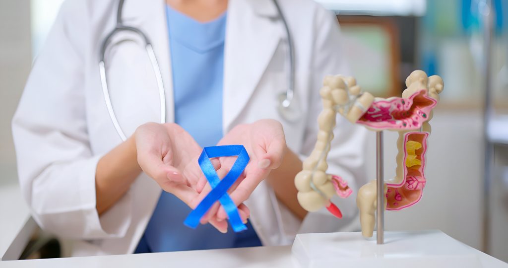 At what age do people get colon cancer