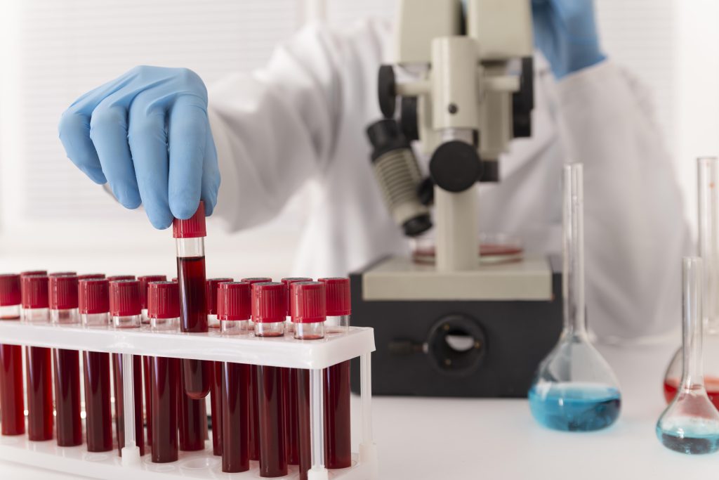 benign hematology diagnosis