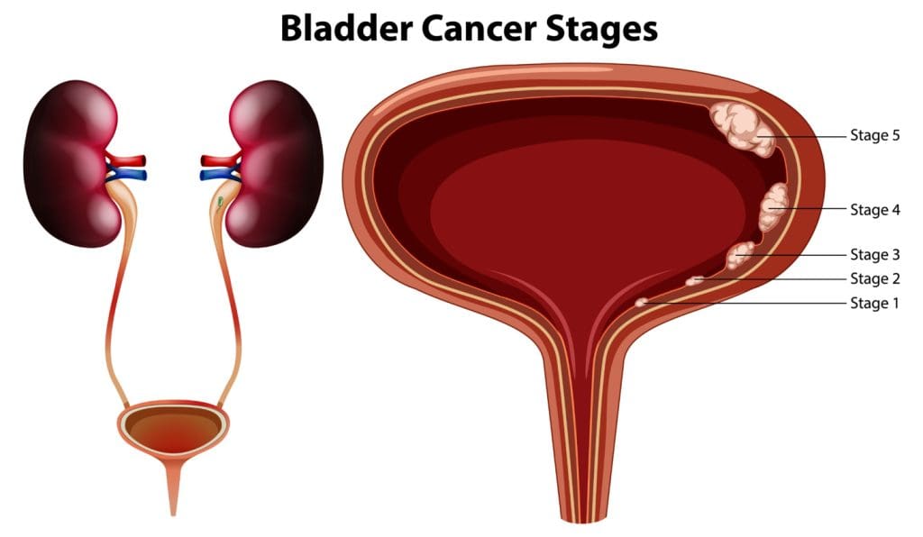 cross-sectional view of a human bladder cross-sectional view of a human bladder