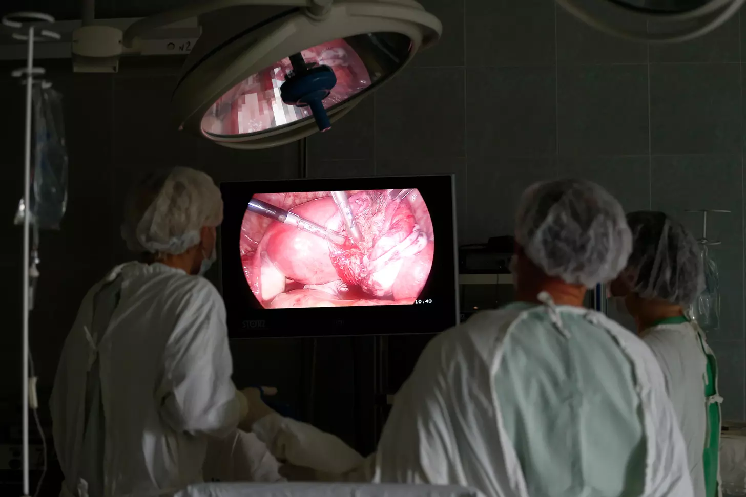 How to Watch a Da Vinci Hysterectomy Video: Step-by-Step Visual Guide