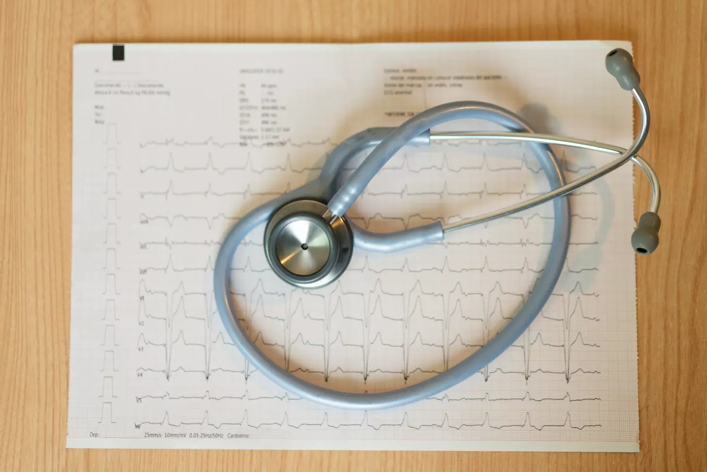 Sinus Arrhythmia Definition: 7 Key Characteristics, Causes, and ECG Differences 1 Sinus Arrhythmia Definition: 7 Key Characteristics, Causes, and ECG Differences