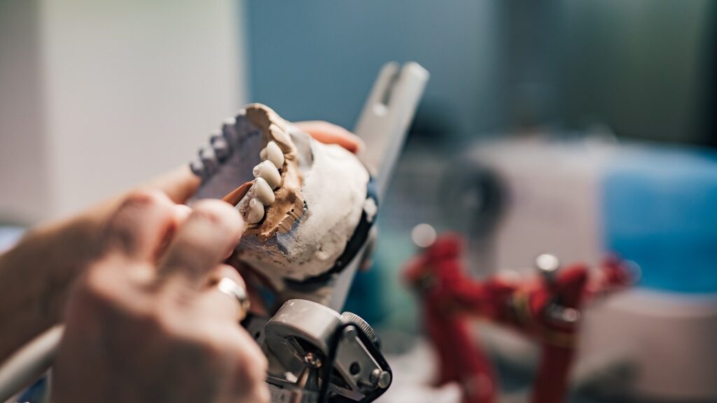 dental bone transplant