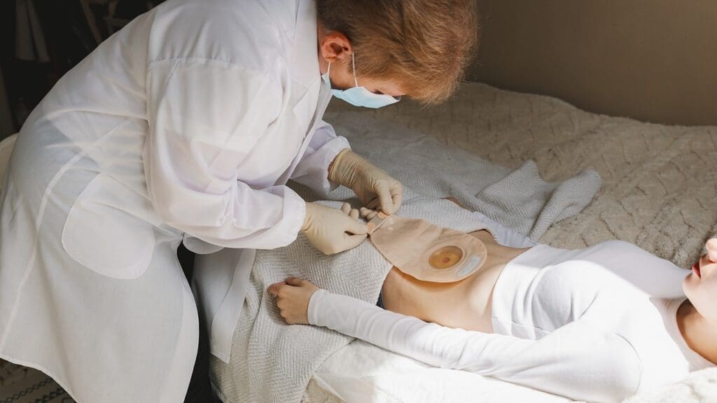 Do You Need a Bag After Prostate Removal? What to Expect During Recovery