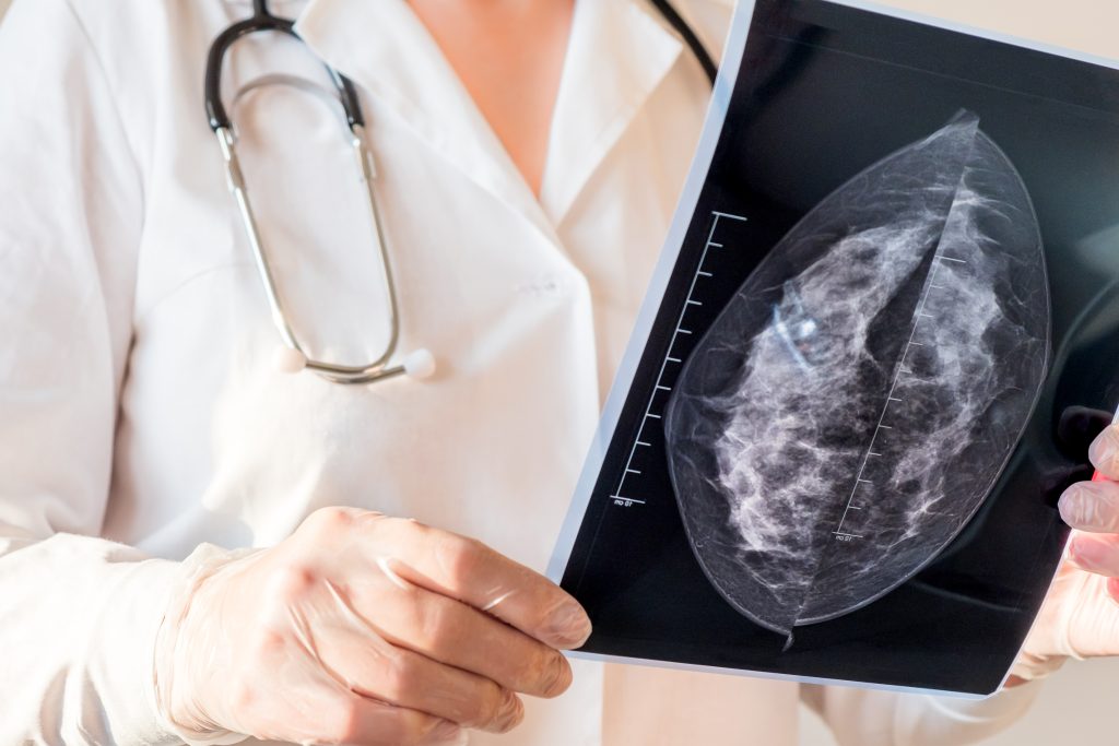 How quickly does colon cancer progress
