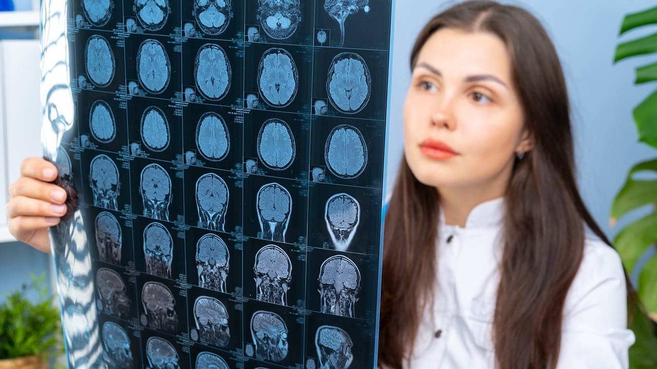 How Long Can You Live with Brain Cancer?