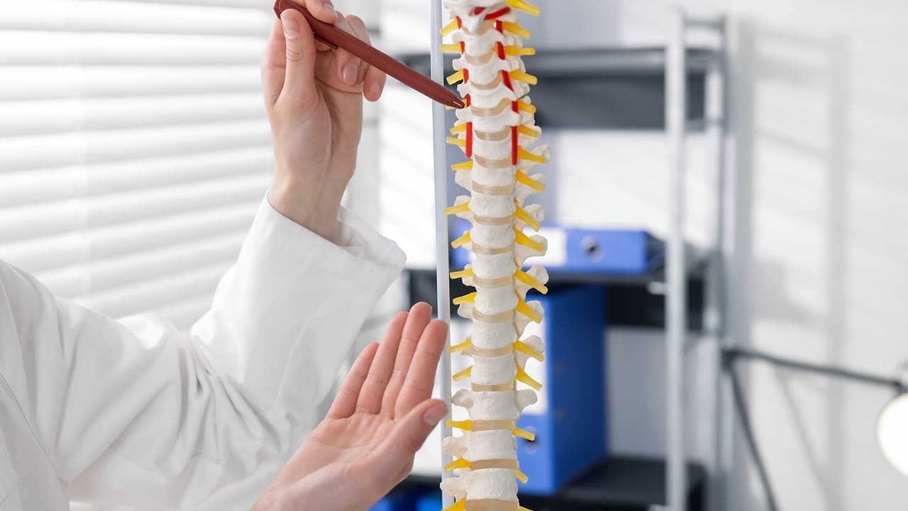 How Long Does a Spinal Cage Last? Long-Term Outcomes and Quality of Life After Spinal Fusion