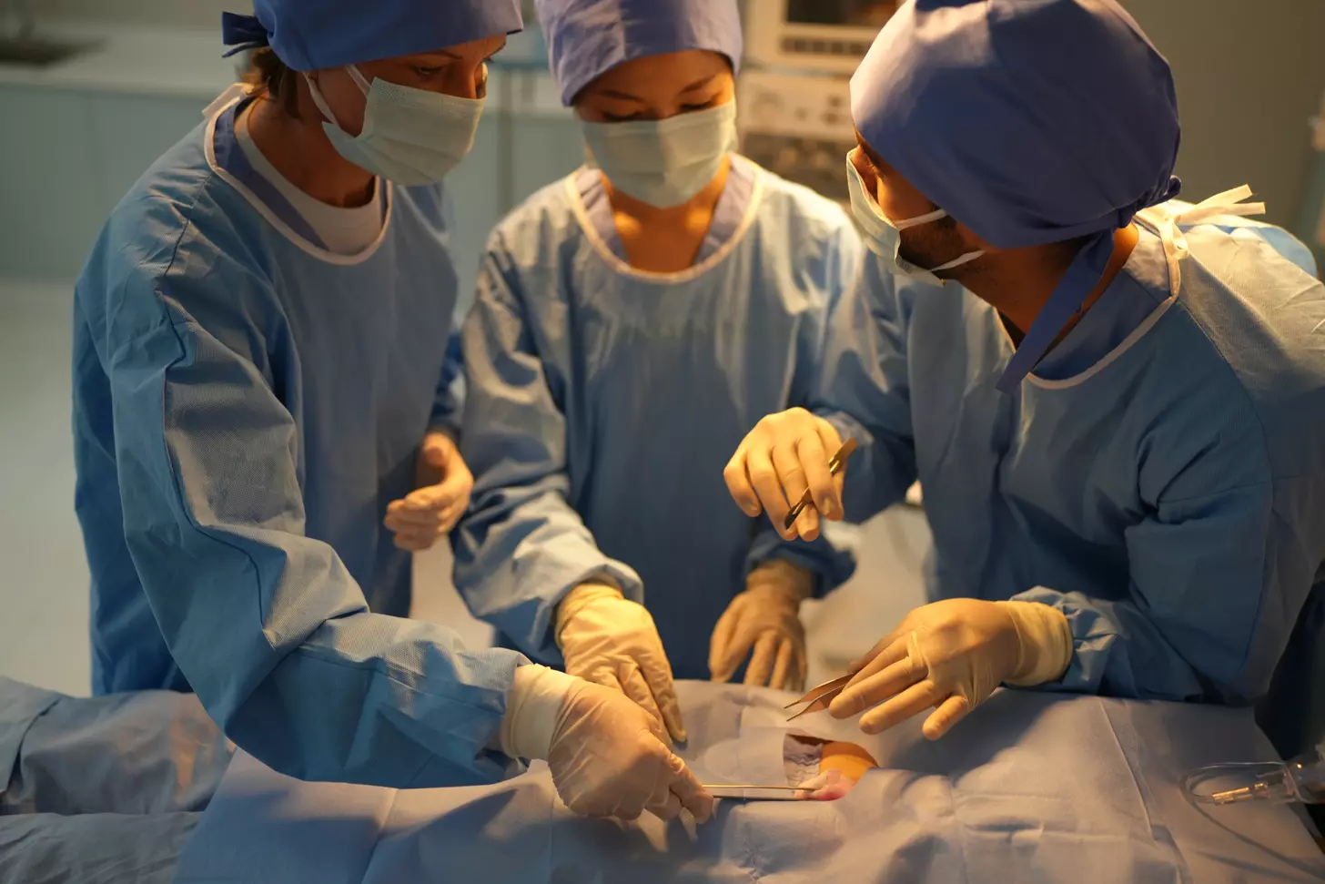 How Long Does Quadruple Bypass Surgery Take and What Recovery Involves?