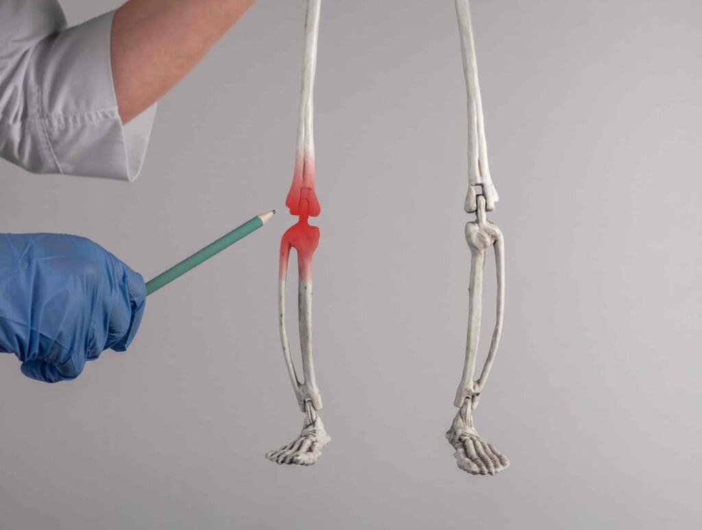 human knee joint showcasing the intricate mechanisms behind non-surgical repair. human knee joint showcasing the intricate mechanisms behind non-surgical repair.