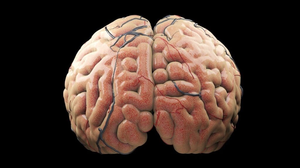 hydrocephalus and cerebrospinal fluid
