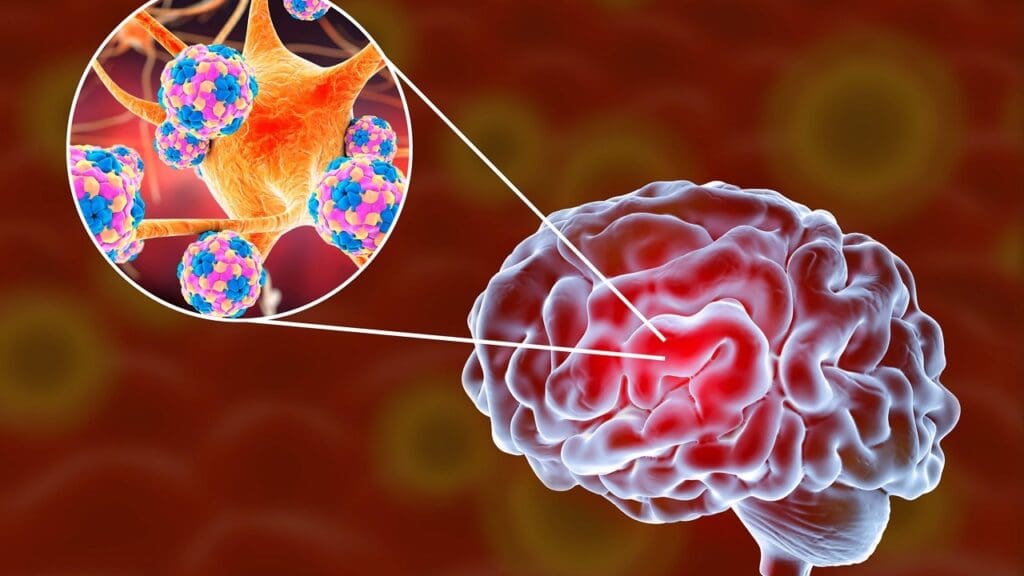 hydrocephalus treatment hydrocephalus treatment