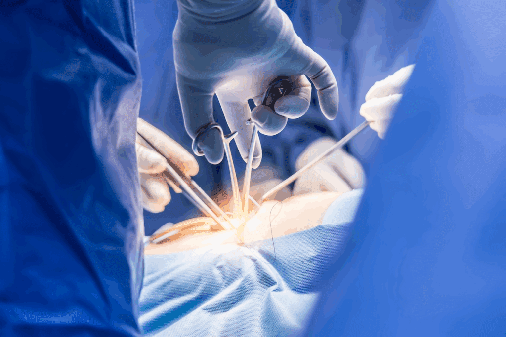 Surgeons Prefer Robotic Surgery: The Shocking Reasons Why