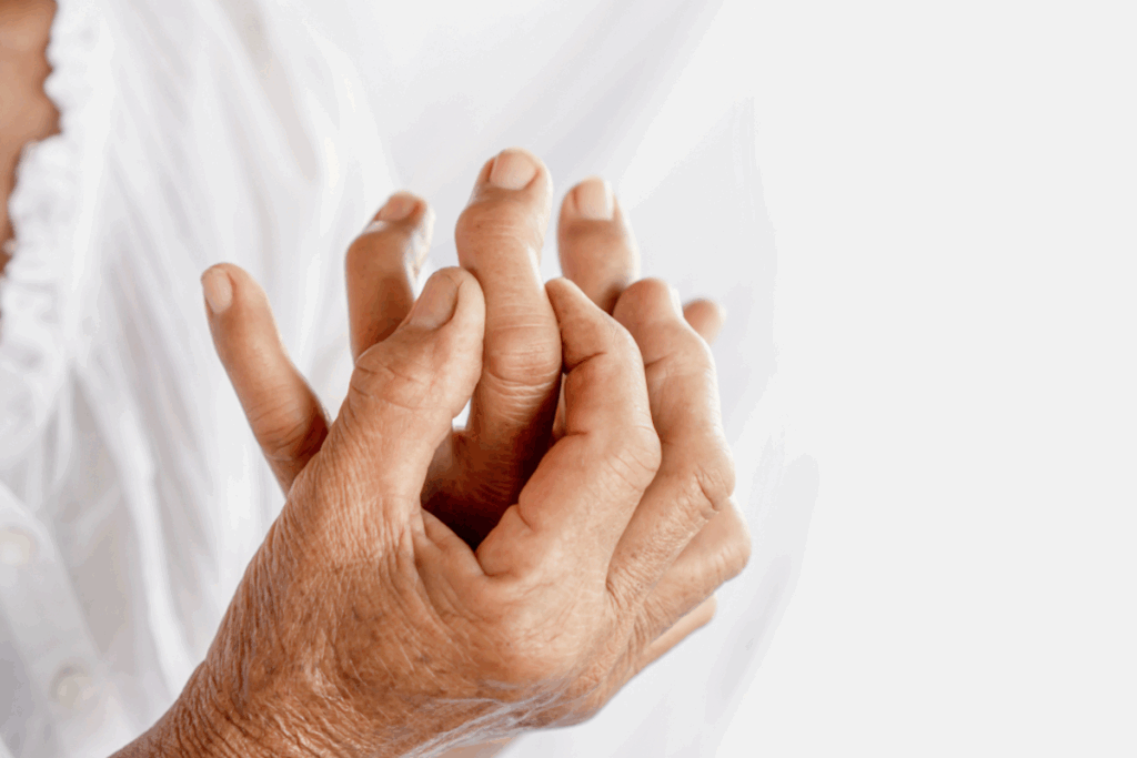 Conditions Mistaken for Osteoarthritis