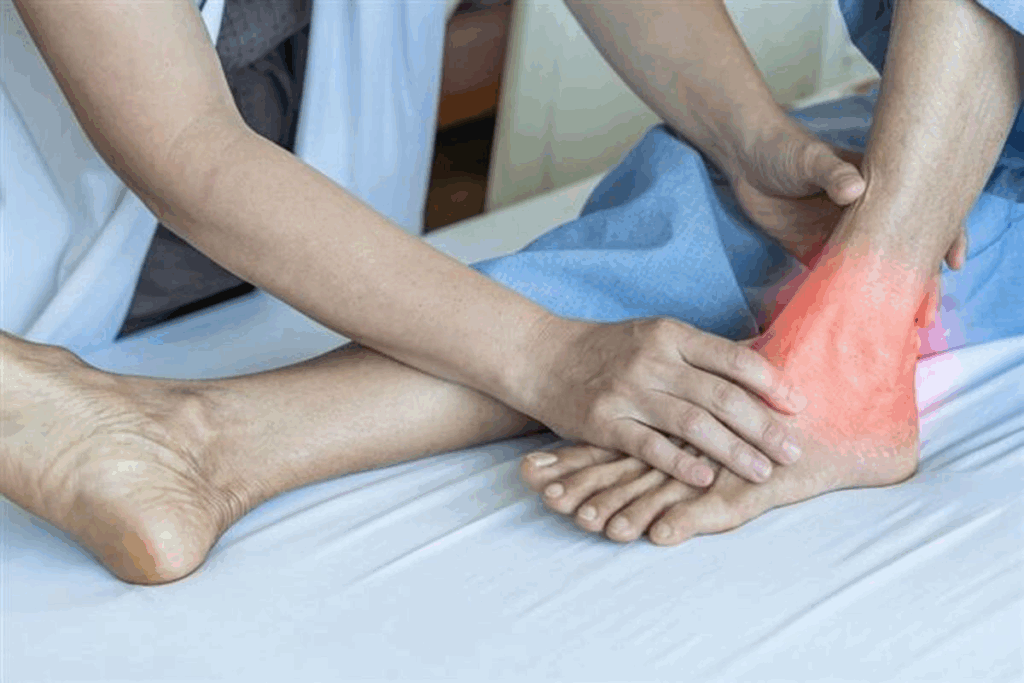 Small Achilles Tendon Tear Symptoms: 4 Crucial Signs Uncovered