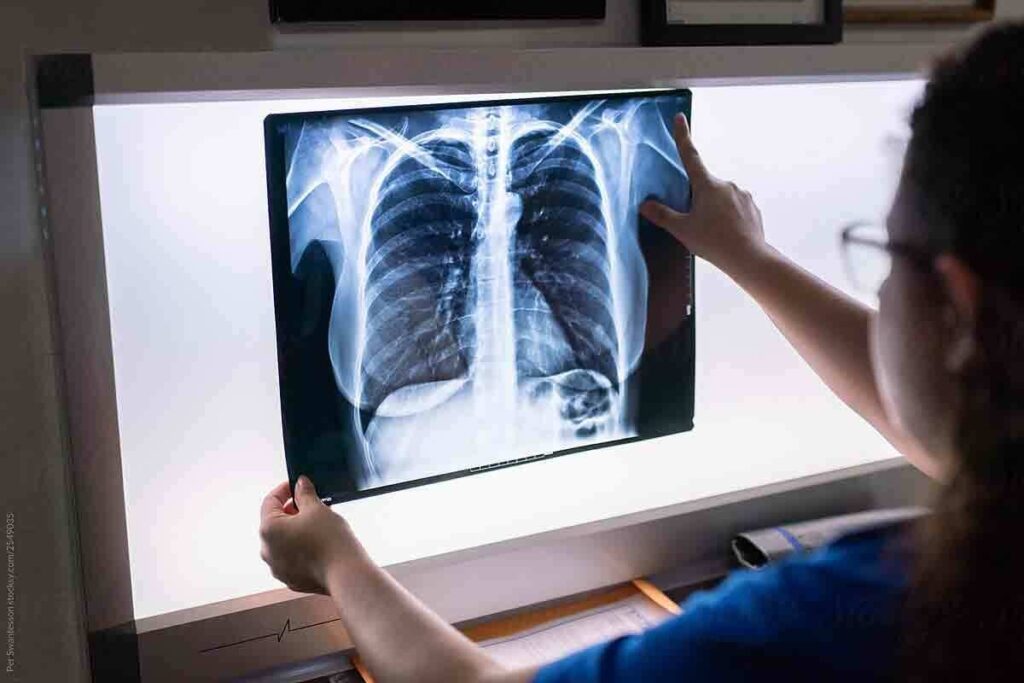 How Many PET Scans Can You Have in a Lifetime? Guide