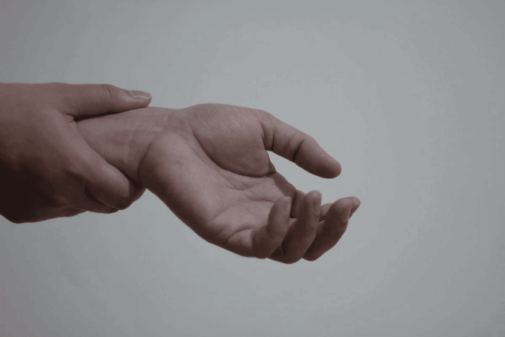 Why Fingers Numb with Carpal Tunnel Syndrome