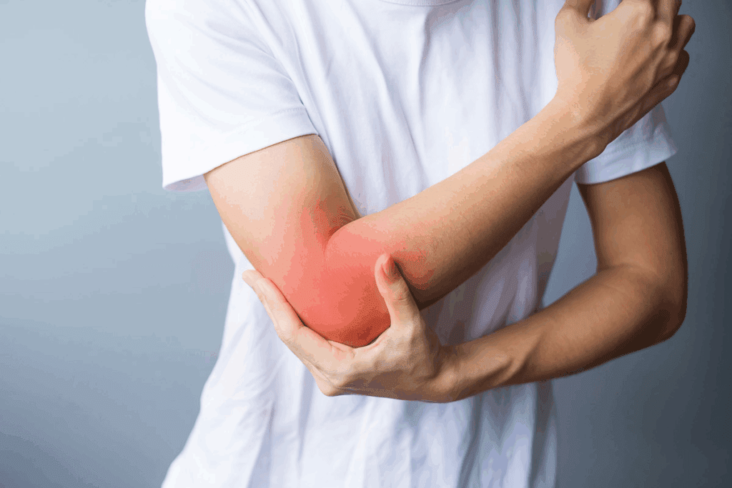 Long-Term Trochanteric Bursitis Prognosis and Recovery