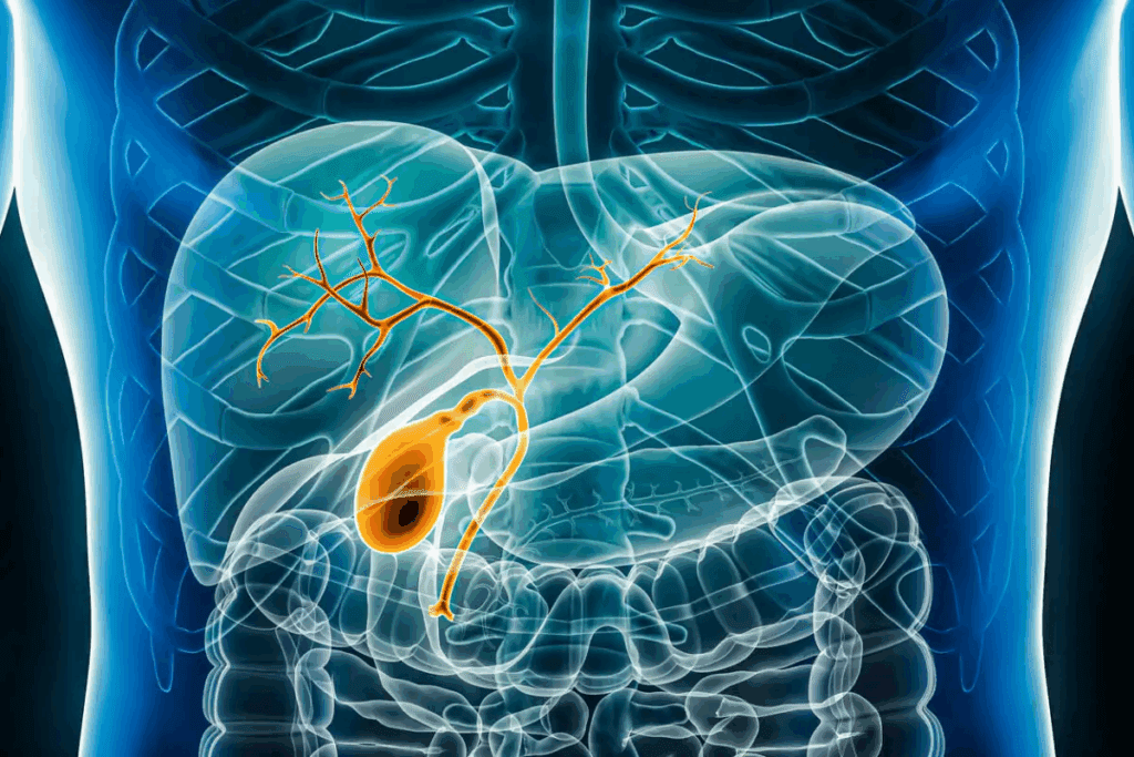 How Complicated Is Bile Duct Removal Surgery? Bad Truth