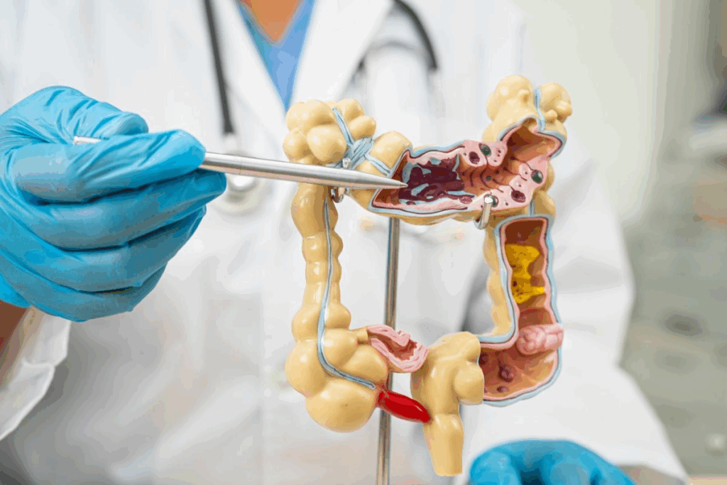 Colon Cancer Operation Procedure: 7 Key Steps