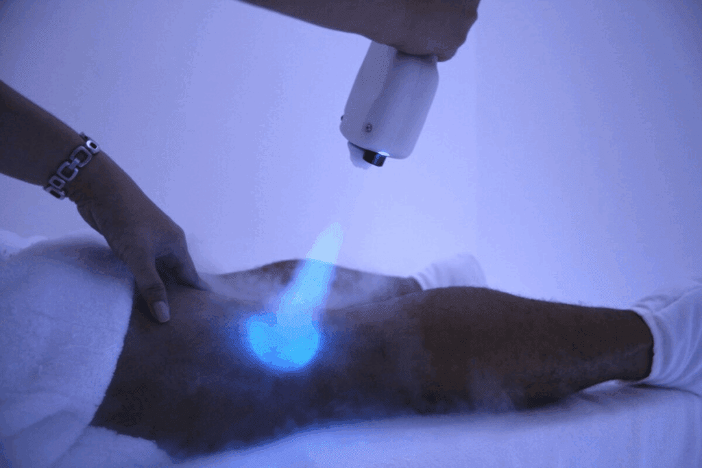 5 Best Ways Cryo Cancer Using Extreme Cold
