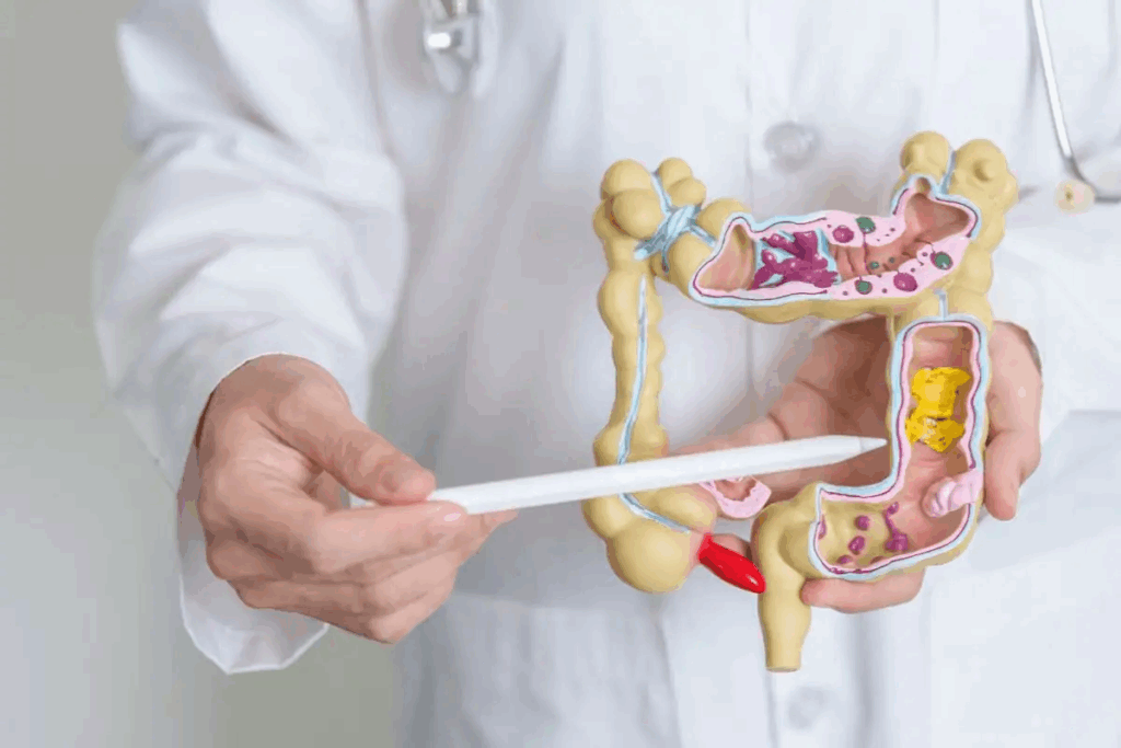 What Is the Symptoms of Colon Polyps Explained