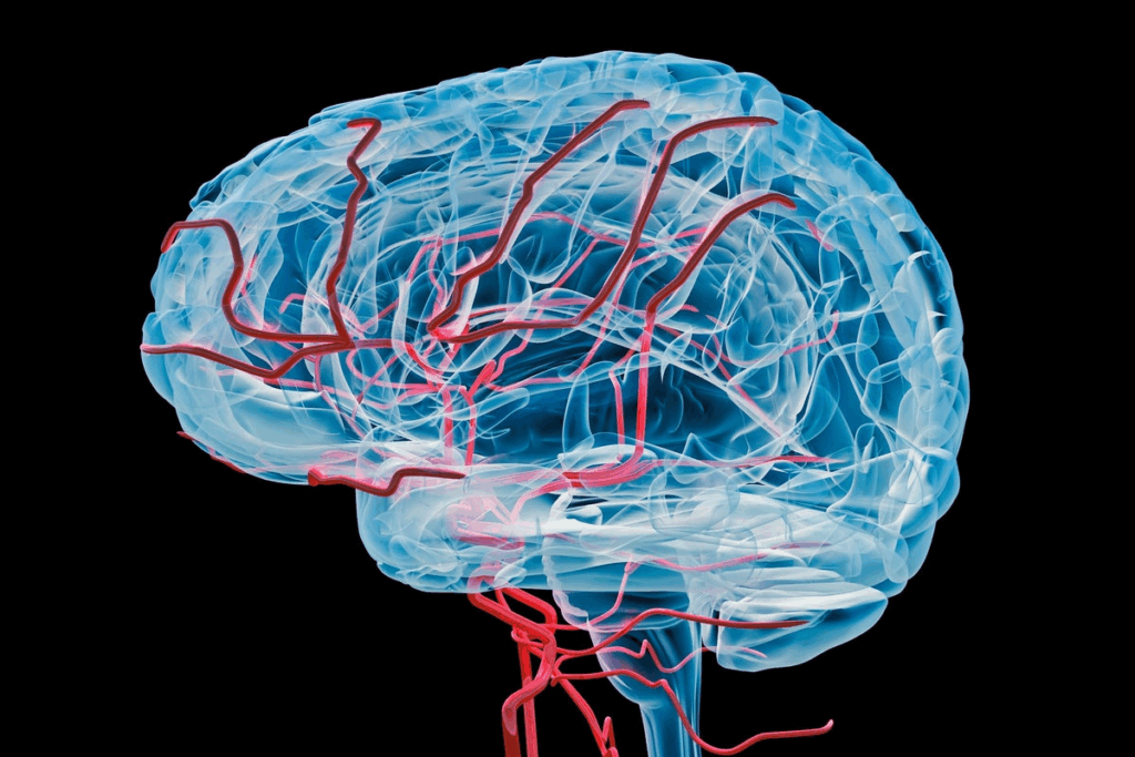 How to Perform a cerebral coiling procedure for Brain Aneurysm Treatment