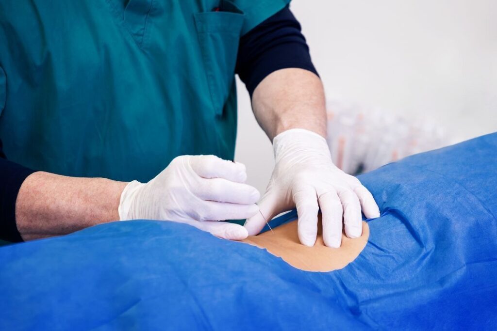 Complications of Kids' Inguinal Hernia Surgery