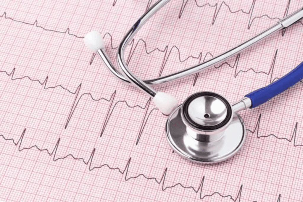Arrhythmia Versus Dysrhythmia: Full Comparison