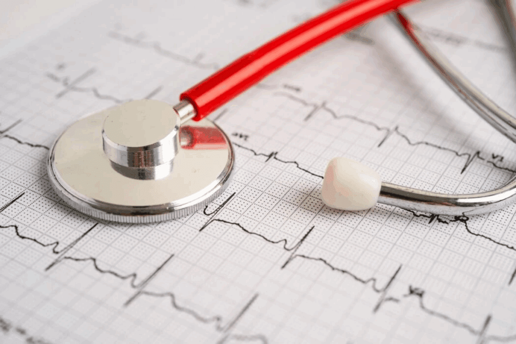 12 Lead Cardiogram: Heart Diagnosis Explained