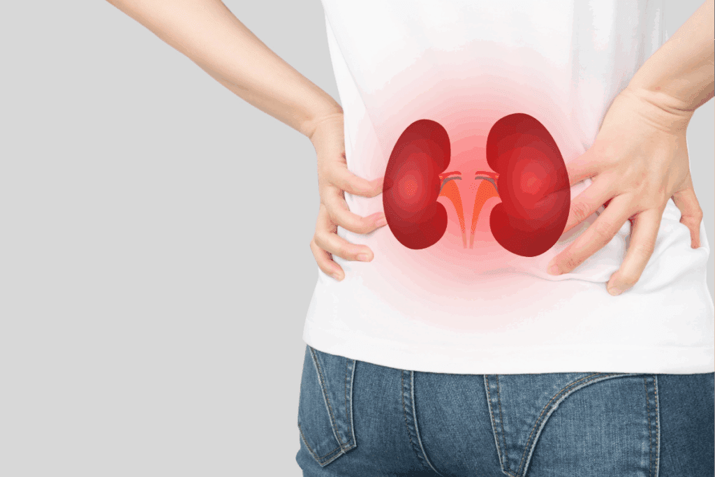 Dark Kidney Stones: Causes & Prevention