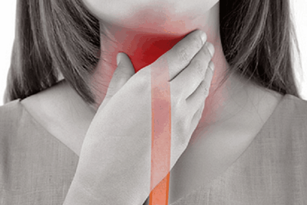 Acute Pharyngolaryngitis Symptoms and Treatment