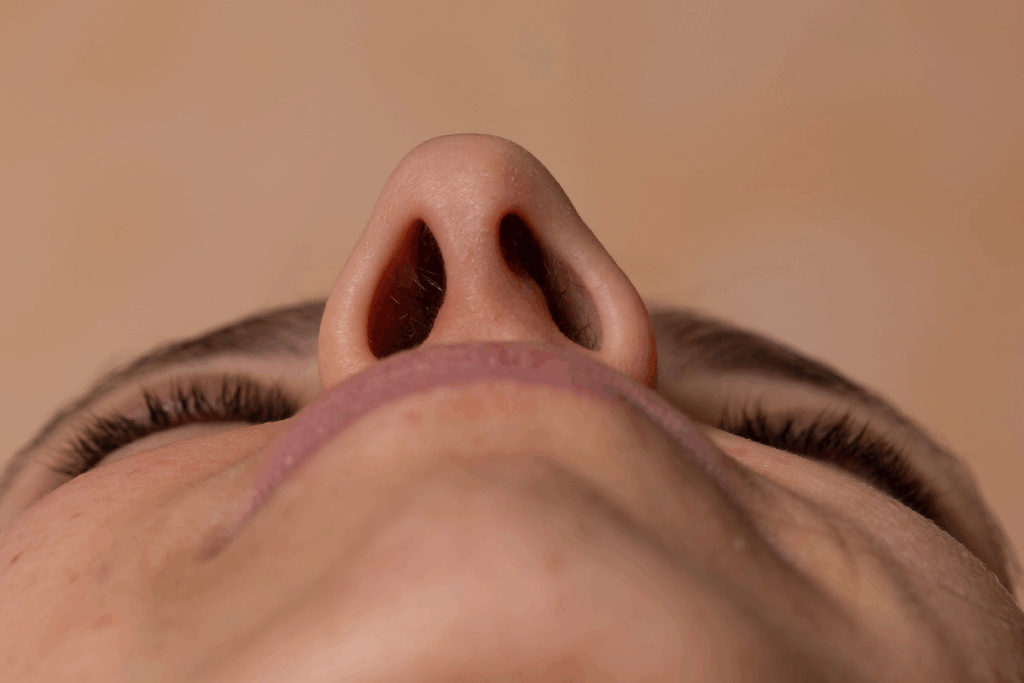 Deviated Septum Surgery Before and After Results