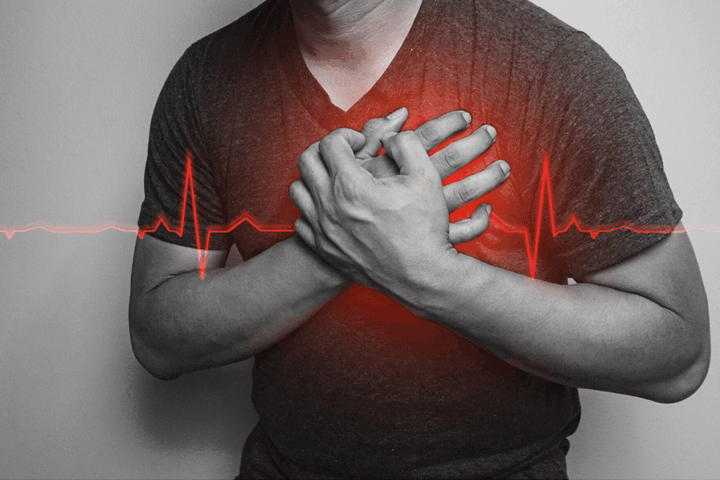 Do Kidney Stones Cause Chest Pain?