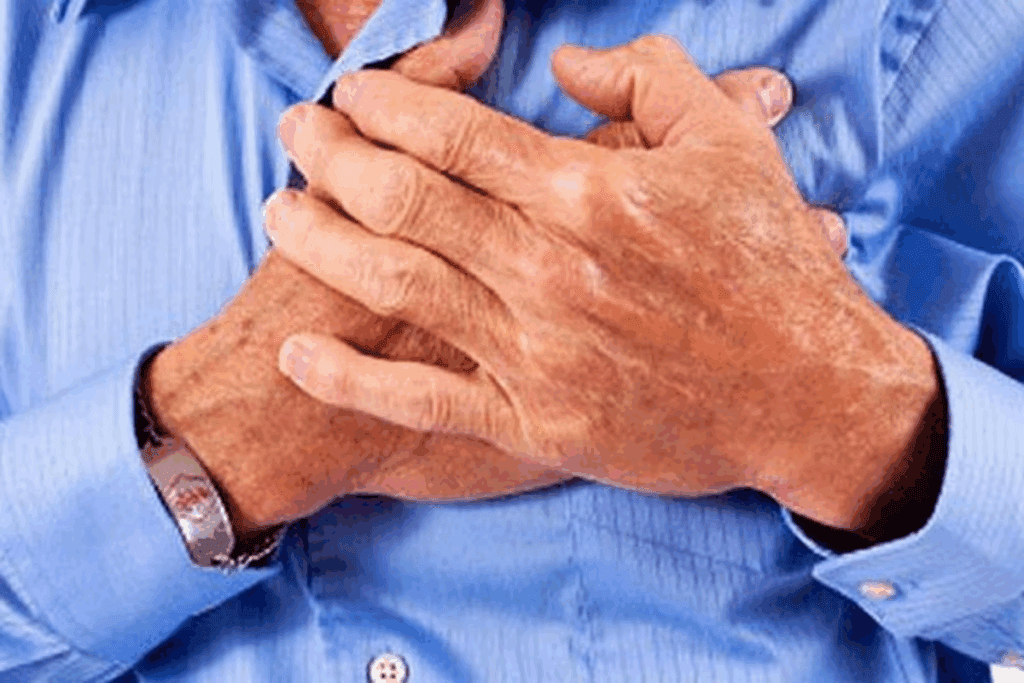 Kidney Stones and Chest Pain: Symptoms