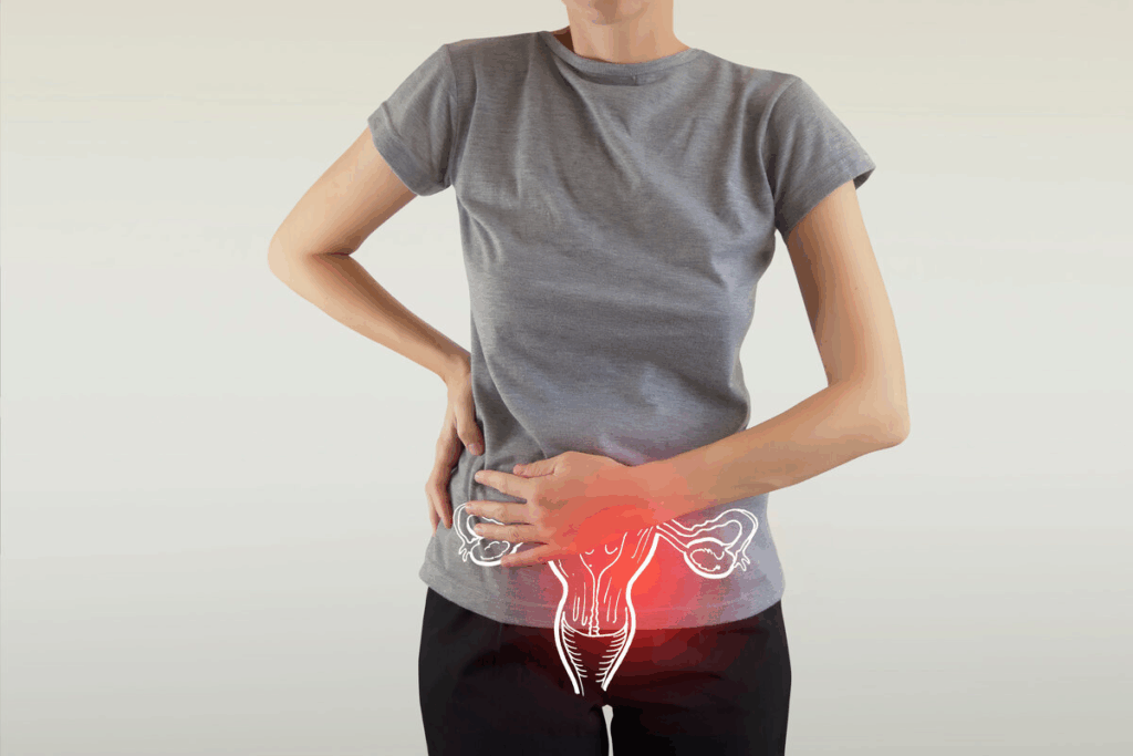 Urinary Stones: Symptoms of Bladder Stones in Women