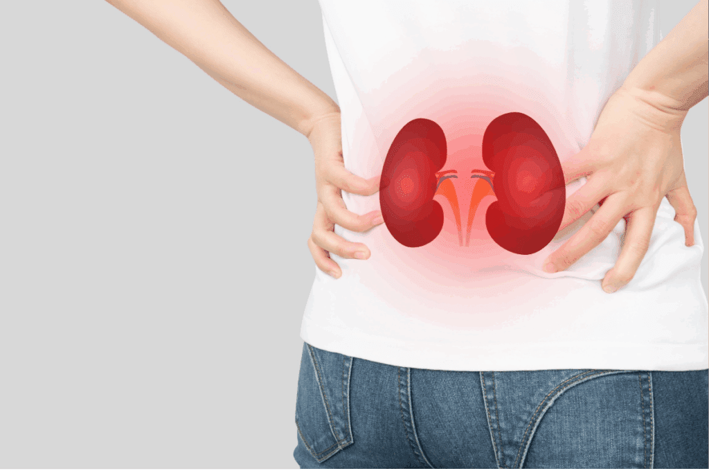 Blood Infection from Kidney Stone: Causes, Risks & Treatment