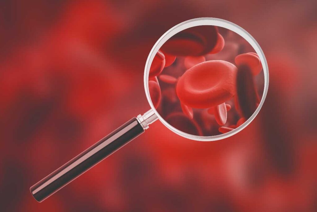 10 Key Signs and Symptoms of Aplastic Anemia (With Common Causes)