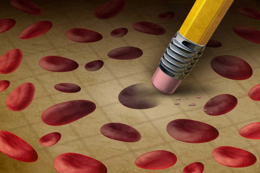 10 Key Signs and Symptoms of Aplastic Anemia (With Common Causes)