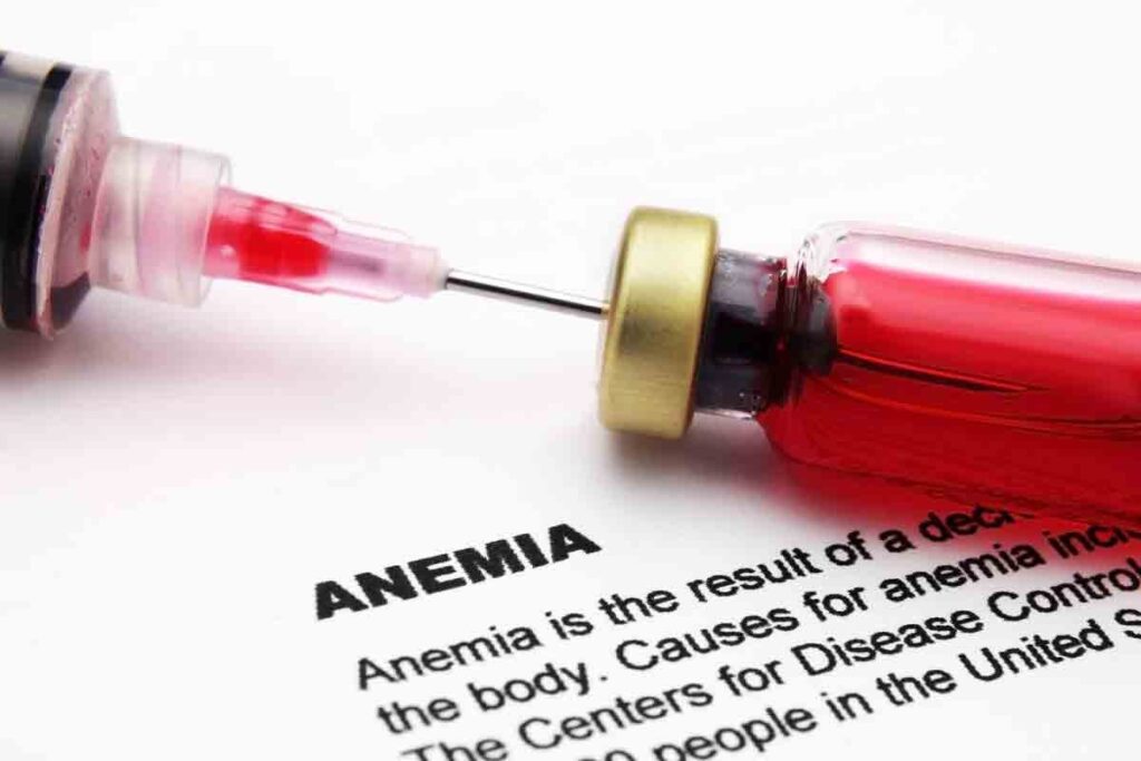 How Can You Check for Anemia in the Eyes And Does Low Iron Cause Blurry Vision?
